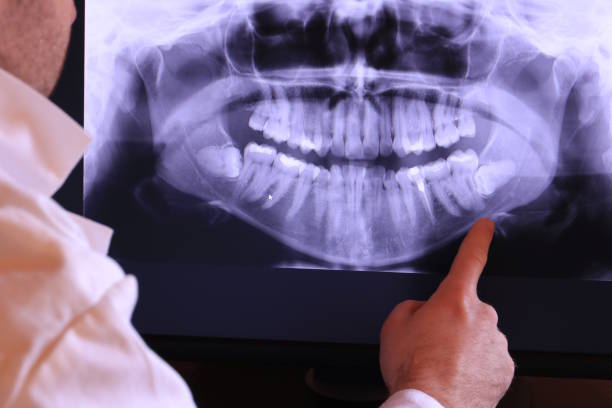 Best Urgent Dental Care for Toothache in Canterwood, WA