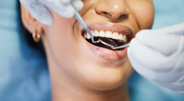 Best Emergency Dentist for Knocked-Out Tooth in Canterwood, WA