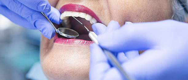 Best Broken or Cracked Tooth Emergency Dentist in Canterwood, WA